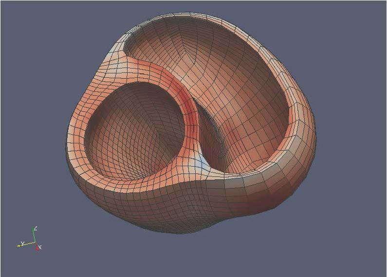 Computer generated cardiac model